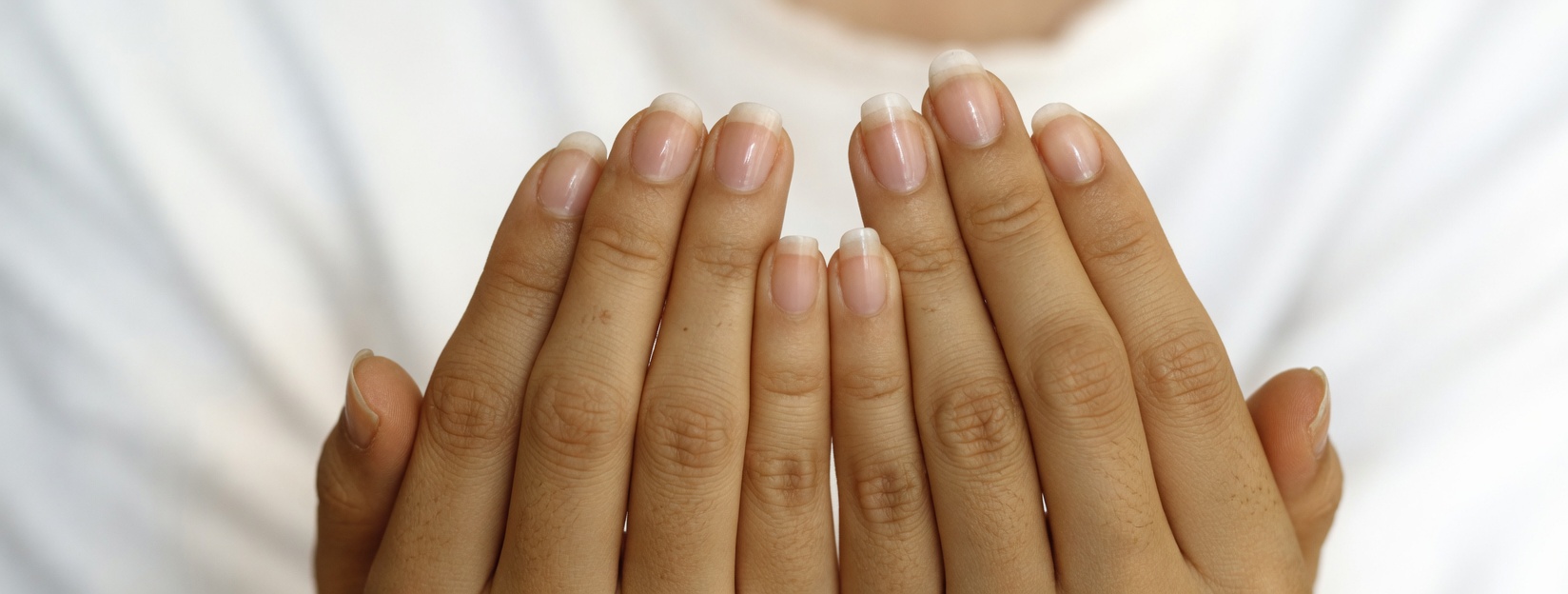 O suco de limão pode ajudar a manter a pele e as unhas saudáveis contra problemas fúngicos? Uma receita natural simples para experimentar