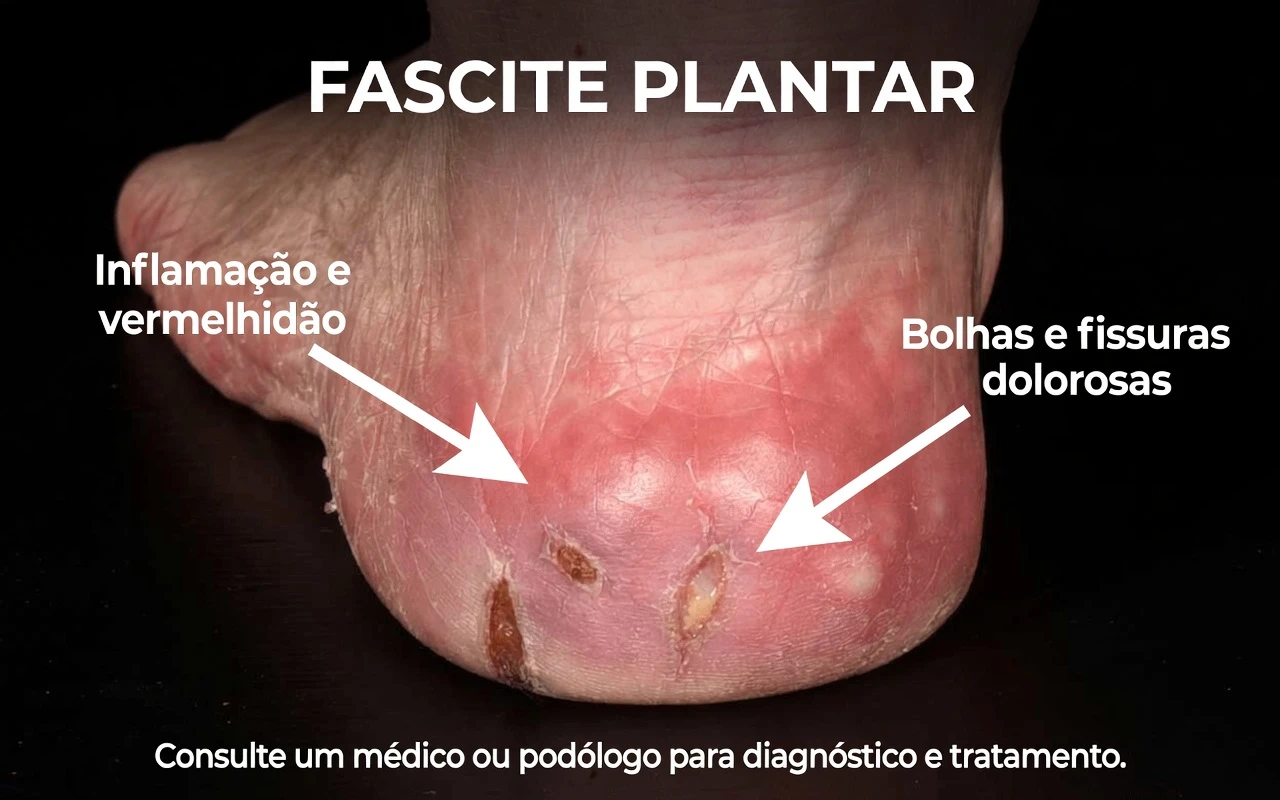 10 Sinais nas Suas Pernas que Podem Indicar Risco de AVC – O que Mulheres Acima de 60 Anos Devem Saber (Aja Antes que Seja Tarde Demais)
