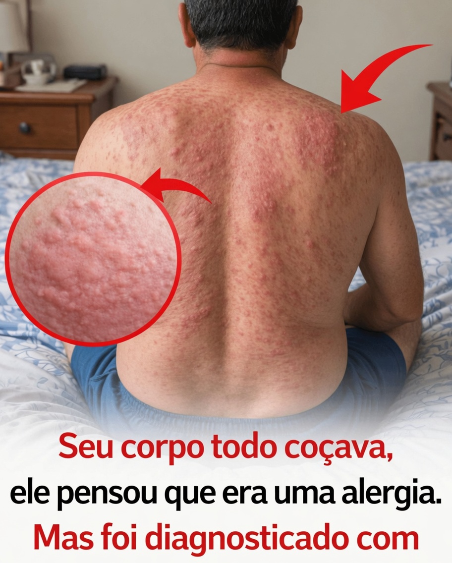 Coceira Persistente Além das Alergias: Quando Pode Sinalizar Algo Mais Grave