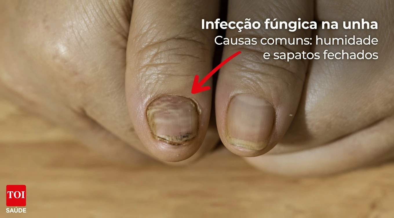 Unhas Quebradiças? 10 Causas Ocultas Que Seu Corpo Pode Estar Sinalizando – E Maneiras Simples de Ajudar a Fortalecer as Unhas