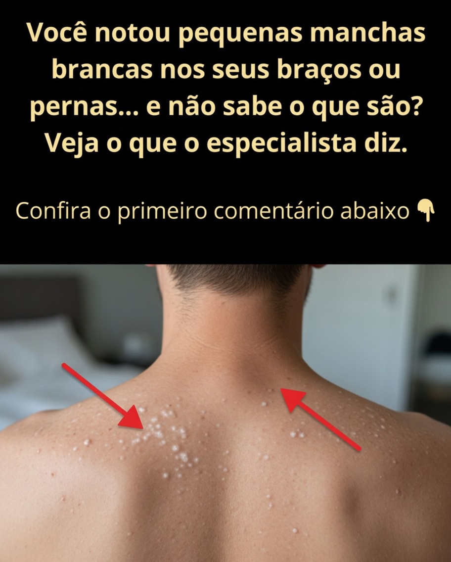 Por que surgem manchas brancas na pele? Causas comuns e o que saber